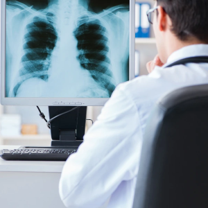 AOI, tia X, ICT Là Gì?